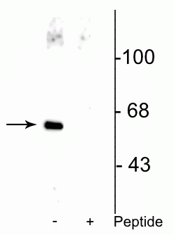 Western blot of HeLa cell lysate showing specific immunolabeling of the ~66 kDa Che-1 protein phosphorylated at Ser477 in the first lane (-). Phosphospecificity is shown in the second lane (+) where immunolabeling is blocked by preadsorption of the phosphopeptide used as the antigen, but not by the corresponding non-phosphopeptide (not shown).