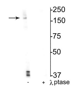Western blot of mouse hippocampal lysate showing specific immunolabeling of the ~180 kDa NR2B subunit of the NMDAR phosphorylated at Ser1166 in the first lane (-). Phosphospecificity is shown in the second lane (+) where immunolabeling is completely eliminated by lysate treatment with lambda phosphatase (1200 units/100uL lysate overnight).
