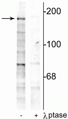 Western blot of rat hippocampal lysate showing specific immunolabeling of the ~180 kDa NR2B subunit phosphorylated at Tyr1252 in the first lane (-). Phosphospecificity is shown in the second lane (+) where immunolabeling is completely eliminated by blot treatment with lambda phosphatase (λ-Ptase, 1200 units for 30 min).