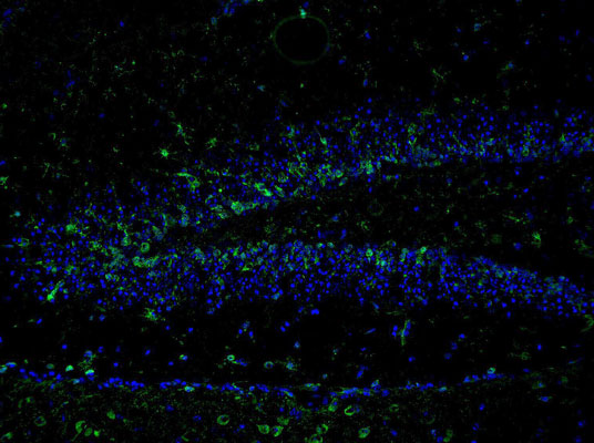 Immunostaining of mouse dentate gyrus 48 hours post TMT treatment showing NR2B when phosphorylated at Tyr1336 (green, 1:400). The blue is staining nuclei using DAPI. Photo Courtesy of Rob Wine.