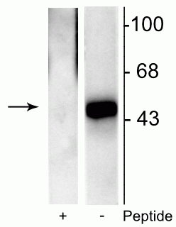 Western blot of recombinant Elk-1 showing specific immunolabeling of the ~46 kDa Elk-1 phosphorylated at Ser383 in the right lane (-). Phosphospecificity is shown in the left lane (+) where immunolabeling is blocked by preadsorption of the phosphopeptide used as the antigen, but not by the corresponding non-phosphopeptide (not shown). 