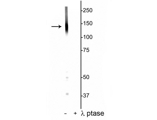Western blot of rat hippocampal lysate showing specific labeling of the ~135 kDa KCC2 protein phosphorylated at Thr1007 in the first lane (-). Phosphospecificity is shown in the second lane (+) where immunolabeling is completely eliminated by blot treatment with lambda phosphatase (λ-Ptase, 1200 units for 30 min).