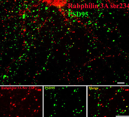 Immunostaining of 14 DIV rat cortical neurons labeling rabphilin when phosphorylated at Ser234 (cat. p1553-234, red, 1:400) and PSD95 (green). The rat cortical neurons were fixed with methanol at -20C for 10 minutes. Photo courtesy of Gang Liu.