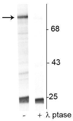 Western blot of UV treated human Jurkat cell lysate showing specific immunolabeling of the ~74 kDa Raf-1 protein phosphorylated at Ser301 in the first lane (-). Phosphospecificity is shown in the second lane (+) where the immunolabeling is completely eliminated by blot treatment with lambda phosphatase (λ-Ptase, 1200 units for 30 minutes). 