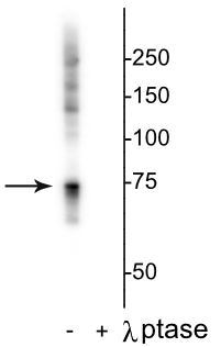 Western blot of HeLa lysate showing specific labeling of the ~74 kDa Raf 1 protein phosphorylated at Ser642 in the first lane (-). Phosphospecificity is shown in the second lane (+) where the immunolabeling is completely eliminated by blot treatment with lambda phosphatase (λ-Ptase, 1200 units for 30 minutes). 