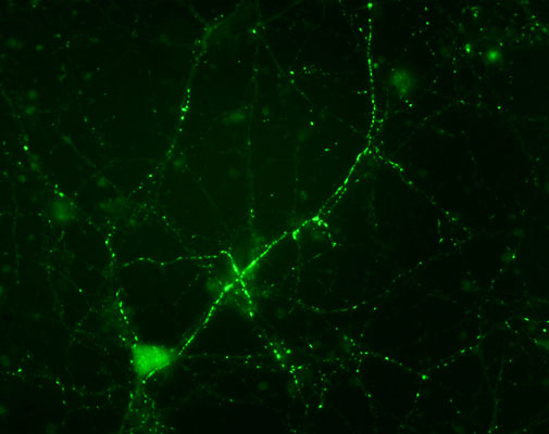 Immunostaining of cultured mouse caudate neurons showing synapsin I when phosphorylated at Ser549(cat. p1560-549, green, 1:500). Cells and photo courtesy of QBMCellScience.