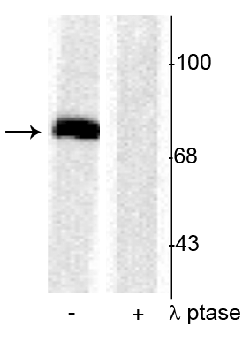 Western blot of rat cortical lysate showing specific immunolabeling of the ~78 kDa synapsin I phosphorylated at Ser603 in the first lane (-). Phosphospecificity is shown in the second lane (+) where the immunolabeling is completely eliminated by blot treatment with lambda phosphatase (λ-Ptase, 1200 units for 30 minutes). 
