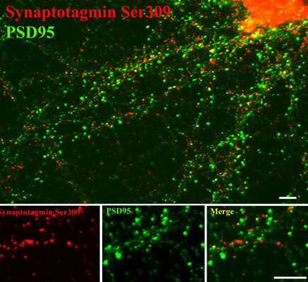 Immunostaining of 14 DIV rat cortical neurons showing synaptotagmin when phosphorylated at Ser309 in red and PSD95 in green. Photo courtesy of Gang Liu.