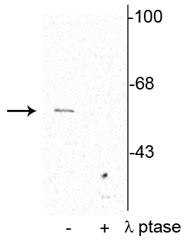 Western blot of rat cortical lysate showing specific immunolabeling of the ~62 kDa synaptotagmin phosphorylated at Thr202 in the first lane (-). Phosphospecificity is shown in the second lane (+) where the immunolabeling is completely eliminated by blot treatment with lambda phosphatase (λ-Ptase, 1200 units for 30 minutes). 