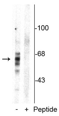 Western blot of rat brain homogenate showing specific immunolabeling of the ~59 kDa, ~65 kDa, ~68 kDa Tau isoforms phosphorylated at Ser416 in the first lane (-). Phosphospecificity is shown in the second lane (+) where immunolabeling is blocked by preadsorption with the phosphopeptide used as antigen, but not by the corresponding non-phosphopeptide (not shown). 