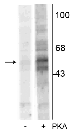 Western blot of recombinant tryptophan hydroxylase incubated in the absence (-) and presence (+) of cAMP-dependent protein kinase showing specific immunolabeling of the ~55 kDa tryptophan hydroxylase protein phosphorylated at Ser58. 
