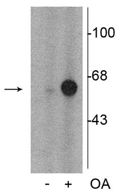 Western blot of PC-12 cell lysate incubated in the absence (-) and presence (+) of okadaic acid (OA, 1 µM for 60 min) showing specific immunolabeling of the ~60 kDa tyrosine hydroxylase phosphorylated at Ser31. 