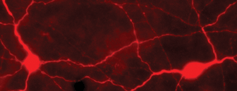 Immunostaining of light-stimulated rabbit retina showing labeling of TH when phosphorylated at Ser40.