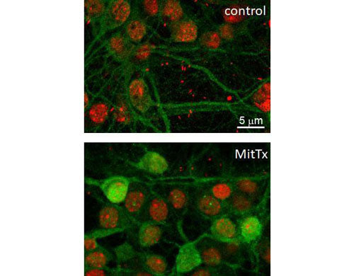 Immunolabeling of cultured mouse hippocampal neurons fixed and stained with anti-phospho-ERK/MAPK Thr202/Tyr204 (p160-2024, green, 1:100) and red nuclear stain Propidium Iodide. The labeling identifies an increase in ERK/MAPK phosphorylation when hippocampal neurons are treated with a specific ASIC1a activator, MitTx toxin (20 nM, 4 min). Image kindly provided by Carina Weissmann, IFIBYNE-CONICET.