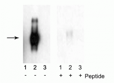 Western blot of immunoprecipitates from HEK 293 cells transfected with 1) Mock, 2) IFNAR1 WT, and 3) IFNAR1 S535A and S539A mutants. Specific immunolabeling of the ~110 kDa to ~130 kDa IFNAR1 WT (2) is shown in the first blot, as the immunolabeling is absent in IFNAR1 Ser535 and Ser539 mutants (3). The specific immunolabeling is blocked by the phosphopeptide (+) used as the antigen in the second blot.