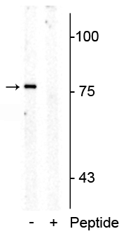 Western blot of rat mid brain membrane lysate showing specific immunolabeling of the ~76 kDa SERT protein phosphorylated at Thr276 in the first lane (-). Phosphospecificity is shown in the second lane (+) where Immunolabeling is blocked by preadsorption of the phosphopeptide used as antigen, but not by the corresponding non-phosphopeptide (not shown). 
