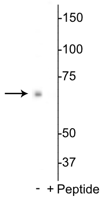 Western blot of Drosophila S2 cell lysate showing specific labeling of the ~70 kDa p70 S6K protein phosphorylated at Thr398 in the first lane (-). Immunolabeling is blocked by preadsorption with the phosphopeptide used as antigen in the second lane (+), but not by the corresponding non-phosphopeptide (not shown). 