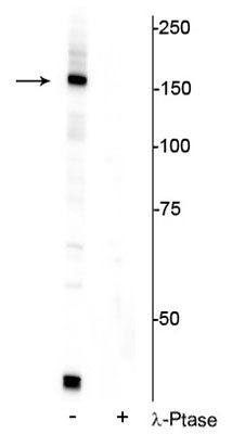 Western blot of HeLa cell lysate showing specific immunolabeling of the ~150 kDa FANCI protein phosphorylated at Ser556 in the first lane (-). Phosphospecificity is shown in the second lane (+) where immunolabeling is completely eliminated by lysate treatment with lambda phosphatase (λ-Ptase, 800 units/1mg protein for 30 min).