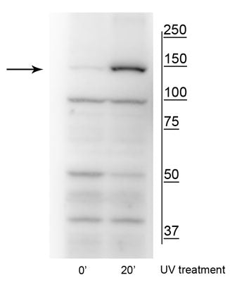 Western blot of HeLa cell lysates that had been treated with UV (~254 nm) for 0’ or 20’ showing specific immunolabeling of the ~150 kDa FANCI protein phosphorylated at Ser559.