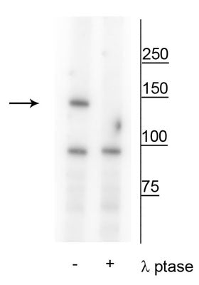 Western blot of Hela cell lysate treated with UV (~254nm) for 20’ showing specific immunolabeling of the ~150 kDa FANCI protein phosphorylated at Ser559 in the first lane (-). Phosphospecificity is shown in the second lane (+) where immunolabeling is completely eliminated by blot treatment with lambda phosphatase (λ-Ptase, 1200 units for 30 min).