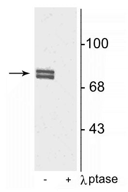Western blot of rat cortical lysate showing specific immunolabeling of the ~80 kDa doublet of 5-LO phosphorylated at Ser523 in the first lane (-). Phosphospecificity is shown in the second lane (+) where immunolabeling is completely eliminated by blot treatment with lambda phosphatase (λ-Ptase, 1200 units for 30 min).