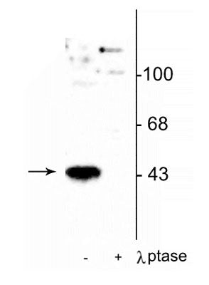 Western blot of human T47D cells showing specific immunolabeling of the ~45 kDa MEK 1 protein phosphorylated at Thr386 in the first lane (-). Phosphospecificity is shown in the second lane (+) where immunolabeling is completely eliminated by blot treatment with lambda phosphatase (λ-Ptase, 1200 units for 30 min).