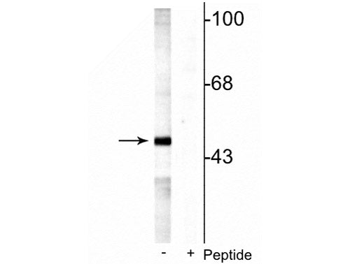 Western blot of rat testes lysate showing specific labeling of the ~49 kDa MEK5 protein phosphorylated at Ser311 Thr315 in the first lane (-). Phosphospecificity is shown in the second lane (+) where immunolabeling is blocked by preadsorption of the phosphopeptide used as the antigen, but not by the corresponding non-phosphopeptide (not shown).