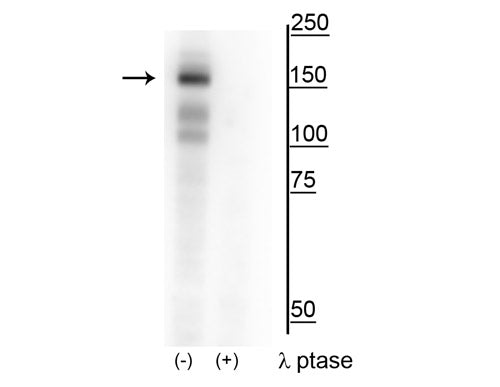 Western blot of HEK293 lysate showing specific immunolabeling of the ~160 kDa MerTK phosphorylated at Tyr749/753/754 in the first lane (-). Phosphospecificity is shown in the second lane (+) where the immunolabeling is completely eliminated by blot treatment with lambda phosphatase (λ-Ptase, 1200 units for 60 minutes).