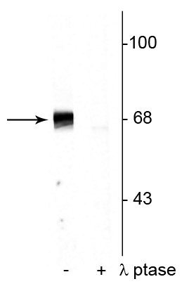 Western blot of rat hippocampal lysate showing specific immunolabeling of the ~68 kDa to ~70 kDa PAK protein phosphorylated at Ser402 in the first lane (-). Phosphospecificity is shown in the second lane (+) where the immunolabeling is completely eliminated by blot treatment with lambda phosphatase (λ-Ptase, 1200 units for 30 minutes). 