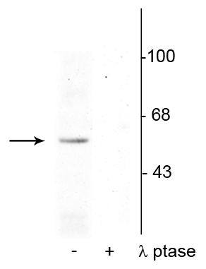 Western blot of rat brain nuclear fraction lysate showing specific immunolabeling of the ~53 kDa p53 phosphorylated at Ser392 in the first lane (-). Phosphospecificity is shown in the second lane (+) where the immunolabeling is completely eliminated by blot treatment with lambda phosphatase (λ-Ptase, 1200 units for 30 minutes). 