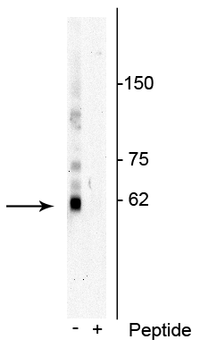 Western blot of Jurkat cell lysate showing specific immunolabeling of the ~62 kDa p62 phosphorylated at Thr269/Ser272 in the first lane (-). Phosphospecificity is shown in the second lane (+) where immunolabeling is blocked by preadsorption of the phosphopeptide used as antigen, but not by the corresponding non-phosphopeptide (not shown). 