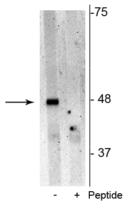 Western blot of Jurkat cell lysate showing specific immunolabeling of the ~48 kDa p62 phosphorylated at Ser28 in the first lane (-). Phosphospecificity is shown in the second lane (+) where immunolabeling is blocked by preadsorption of the phosphopeptide used as antigen, but not by the corresponding non-phosphopeptide (not shown). 