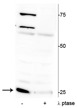 Western blot of mouse heart lysate showing specific immunolabeling of ~25 kDa cardiac troponin I protein phosphorylated at Ser150 in the first lane (-). Phosphospecificity is shown in the second lane (+) where the immunolabeling is completely greatly decreased by blot treatment with lambda phosphatase (λ-Ptase, 1200 units for 30 minutes). 