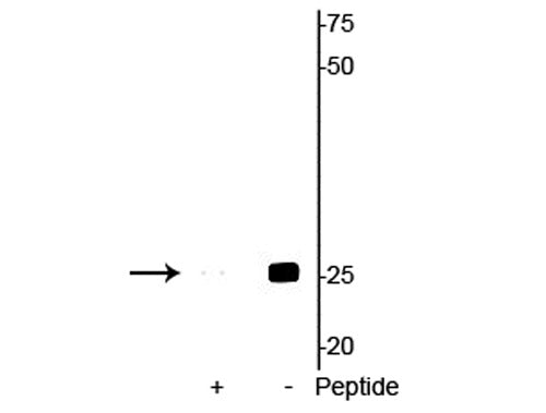 Western blot of mouse heart lysate showing specific immunolabeling of the ~25 kDa cardiac troponin I protein phosphorylated at Ser23/24 in the second lane (-). Phosphospecificity is shown in the first lane (+) where immunolabeling is blocked by preadsorption with the phosphopeptide used as antigen, but not by the corresponding non-phosphopeptide (not shown).