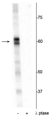 Western blot of Drosophila lysate showing specific immunolabeling of the ~60 kDa PRAS40 protein phosphorylated at Thr356 in the first lane (-). Phosphospecificity is shown in the second lane (+) where the immunolabeling is completely eliminated by blot treatment with lambda phosphatase (λ-Ptase, 1200 units for 30 minutes). 