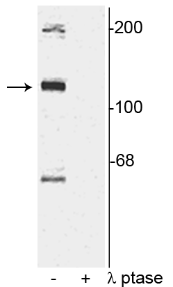 Western blot of rat cortical lysate showing specific immunolabeling of the ~120 kDa TAO2 phosphorylated at Ser181 in the first lane (-). Phosphospecificity is shown in the second lane (+) where the immunolabeling is completely eliminated by blot treatment with lambda phosphatase (λ-Ptase, 1200 units for 30 minutes). 