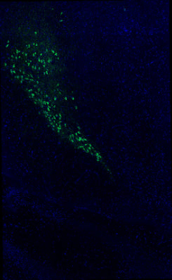 Immunostaining of adult mouse brain section fixed in 4% paraformaldehyde and preserved in cryoprotectant showing specific detection of tyrosine hydroxylase (cat. TYH, 1:500; green) in dopaminergic neurons of the substantia nigra. Nuclei stained with DAPI (blue). Background stain was attenuated with TrueVIEW. Image kindly provided by Ifeoluwa (Hiphy) Awogbindin of the Tremblay Lab, Division of Medical Sciences, University of Victoria, Canada.