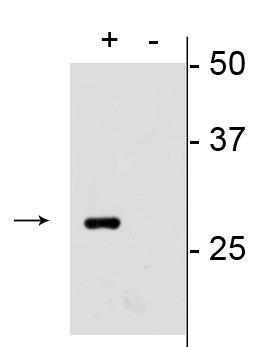 Western blot of mCherry transfected HEK293 cell lysate (+) showing specific immunolabeling of the ~28 kDa mCherry protein. Labeling is absent in the untransfected lysate (-).