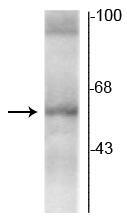 Western blot of rat hippocampal lysate showing specific immunolabeling of the ~58 kDa TR-α2 protein. 