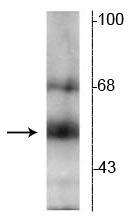Western blot of hippocampal lysate showing specific immunolabeling of the ~55 kDa TR-β protein. 