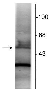 Western blot of rat hippocampal lysate showing specific immunolabeling of the ~48 kDa RAR-α protein.
