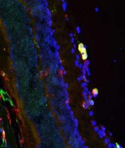 Immunofluorescent image of mouse retina specifically labeling arginase (cat. 146-ARG, 1:500, green) and CD206 (red). The blue nuclear stain is DAPI. The image was kindly provided by Sarah Gough, University of Miami Miller School of Medicine.