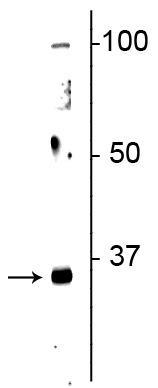 Western blot of neonatal rat brain lysate showing specific immunolabeling of the ~32 kDa Olig2 protein.