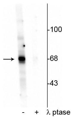 Western blot of Drosophila lysate showing specific labeling of the ~68 kDa AKT protein phosphorylated at Thr342 in the first lane (-). Phosphospecificity is shown in the second lane (+) where the immunolabeling is completely eliminated by blot treatment with lambda phosphatase (λ-Ptase, 1200 units for 30 minutes).
