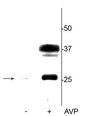 Western blot of rat kidney lysate showing specific immunolabeling of the ~29 kDa and 37 kDa glycosylated form of the AQP2 protein phosphorylated at Ser264 in the vasopressin (AVP) treated lane (+), but not in the control lane (-).