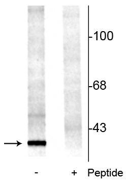 Western blot of rat brainstem lysate showing specific immunolabeling of the ~29 kDa 14-3-3 protein phosphorylated at Ser58 (-). The immunolabeling is blocked by the phosphopeptide used as the antigen (+) but not by the corresponding non-phosphopeptide (not shown).