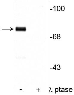 Western blot of rat cortical lysate showing specific immunolabeling of the ~78 kDa synapsin I phosphorylated at Ser9 in the first lane (-). Phosphospecificity is shown in the second lane (+) where the immunolabeling is completely eliminated by blot treatment with lambda phosphatase (λ-Ptase, 1200 units for 30 minutes).