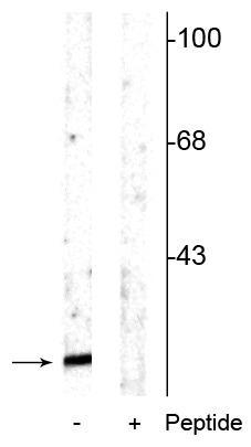 Western blot of rat cortical lysate showing specific immunolabeling of the ~15 kDa alpha synuclein protein phosphorylated at Ser129 in the first lane (-). Phosphospecificity is shown in the second lane (+) where the immunolabeling is blocked by the phosphopeptide used as antigen but not by the corresponding non-phosphopeptide (not shown).