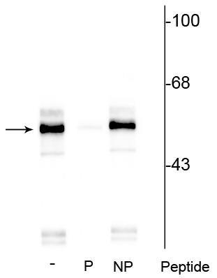 Western blot of rat brainstem lysate showing specific immunolabeling of the ~55 kDa TPH protein phosphorylated at Ser260 in lane one (-). Phosphospecificity is shown in the second lane (P) where immunolabeling is blocked by preadsorption with the phosphopeptide used as antigen, but not by the corresponding non-phosphopeptide (NP), shown in the third lane.