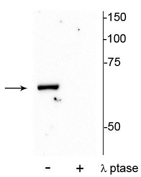 Western blot of mouse hippocampal lysate showing specific immunolabeling of the ~68 kDa PAK1 protein phosphorylated at Thr84 in the first lane (-). Phosphospecificity is shown in the second lane (+) where the immunolabeling is completely eliminated by lysate treatment with lambda phosphatase (λ-Ptase , 800 units/1mg protein for 30 minutes).